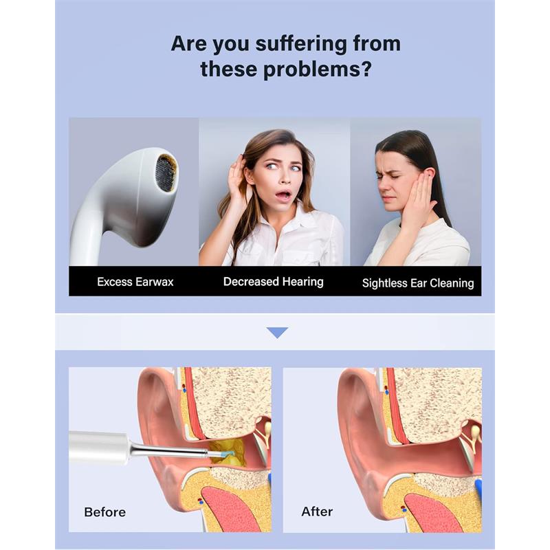 BEBIRD T5 3MP KAMERA 3.5MM LENS ŞARJLI WIFI GÖRÜNTÜLÜ KULAK TEMİZLEYİCİ BEYAZ RENK -4283049