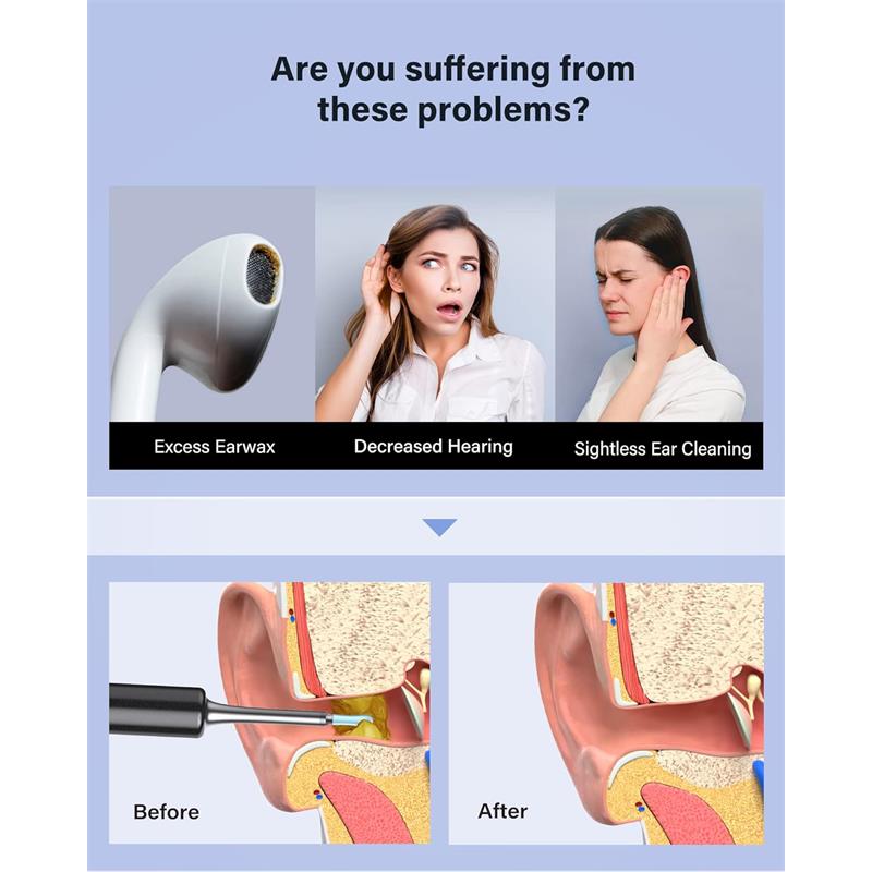 BEBIRD T5 3MP KAMERA 3.5MM LENS ŞARJLI WIFI GÖRÜNTÜLÜ KULAK TEMİZLEYİCİ SİYAH RENK -4261689